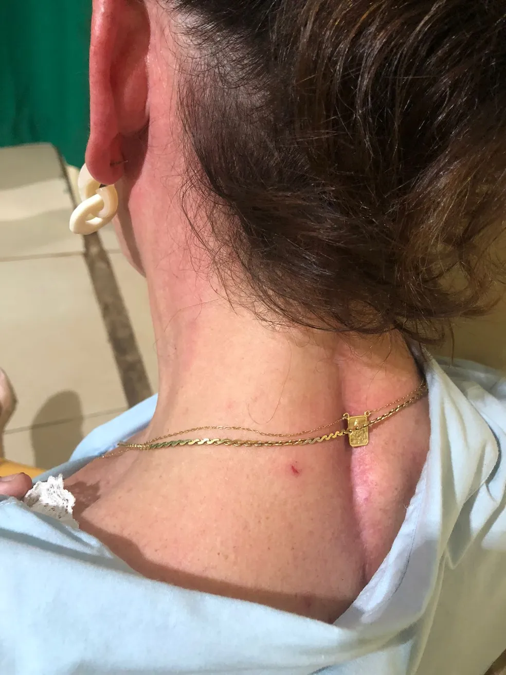 Advogada é agredida por policial civil após se envolver em acidente em Pinheiro - MA