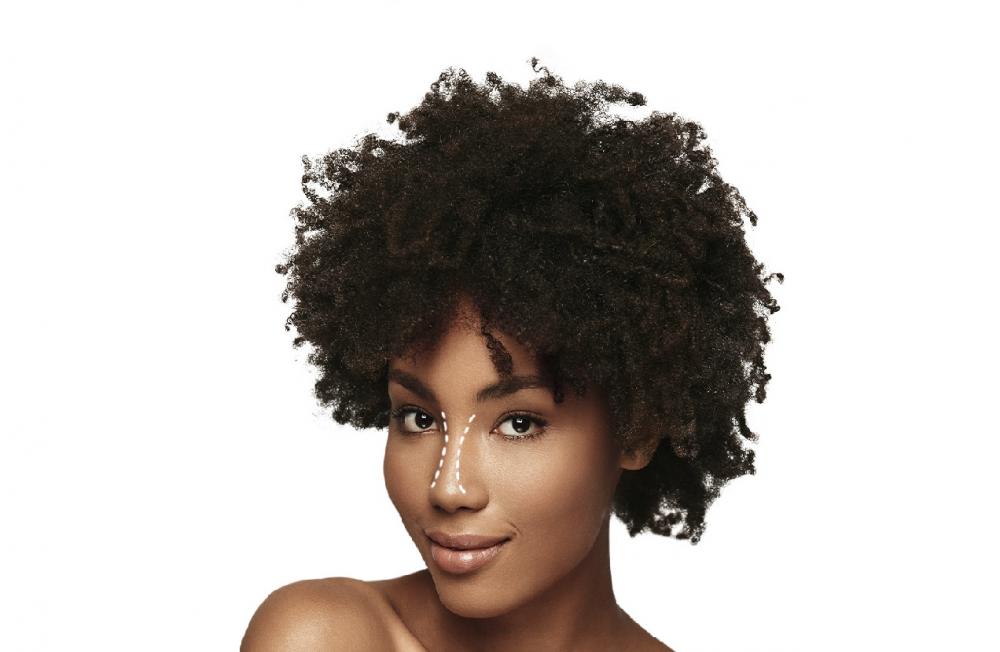 Melhora da autoestima é um dos efeitos da cirurgia plástica do nariz, afirmam especialistas