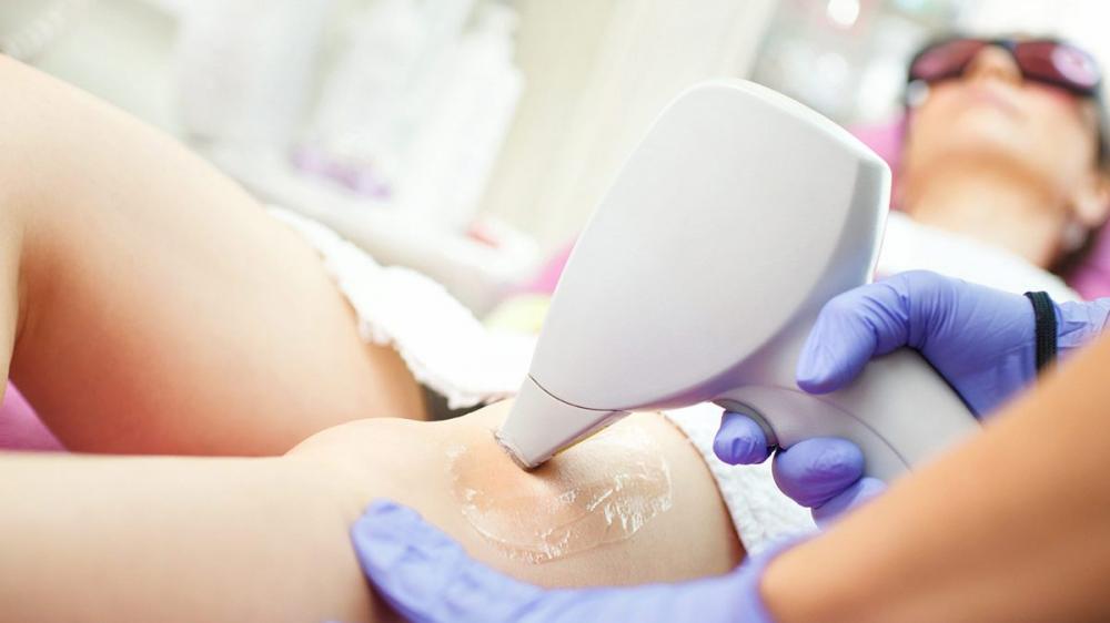 Depilação a laser pode ajudar quem tem pelos encravados ou excessos no corpo
